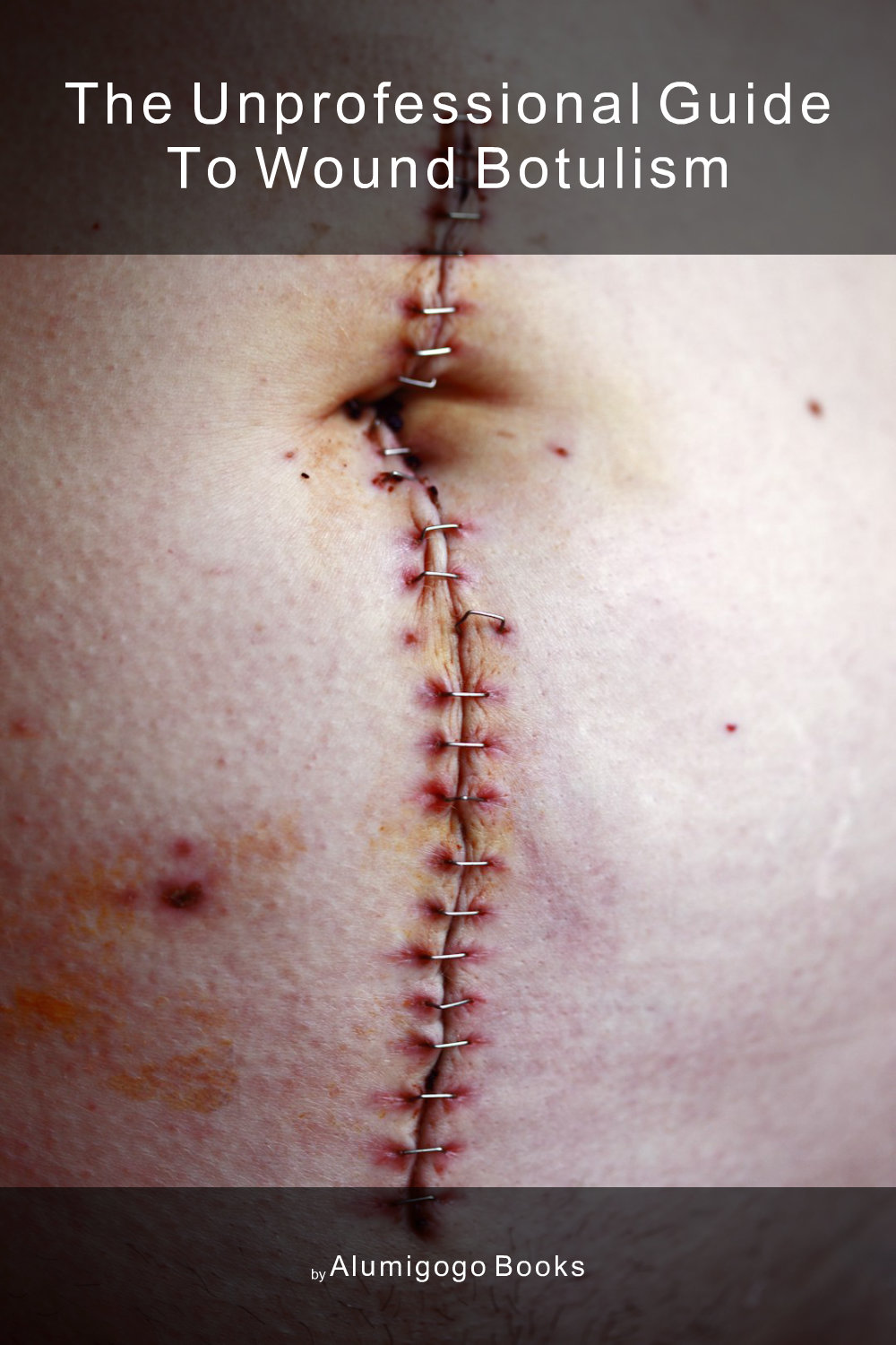 Cover of The Unprofessional Guide to wound botulism