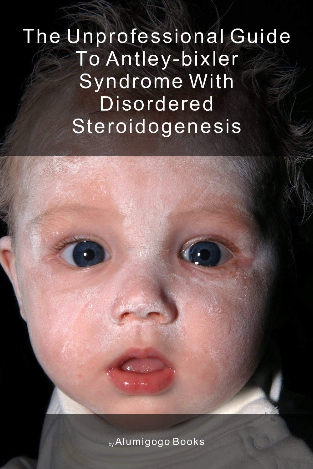 Cover of The Unprofessional Guide to Antley-Bixler syndrome with disordered steroidogenesis