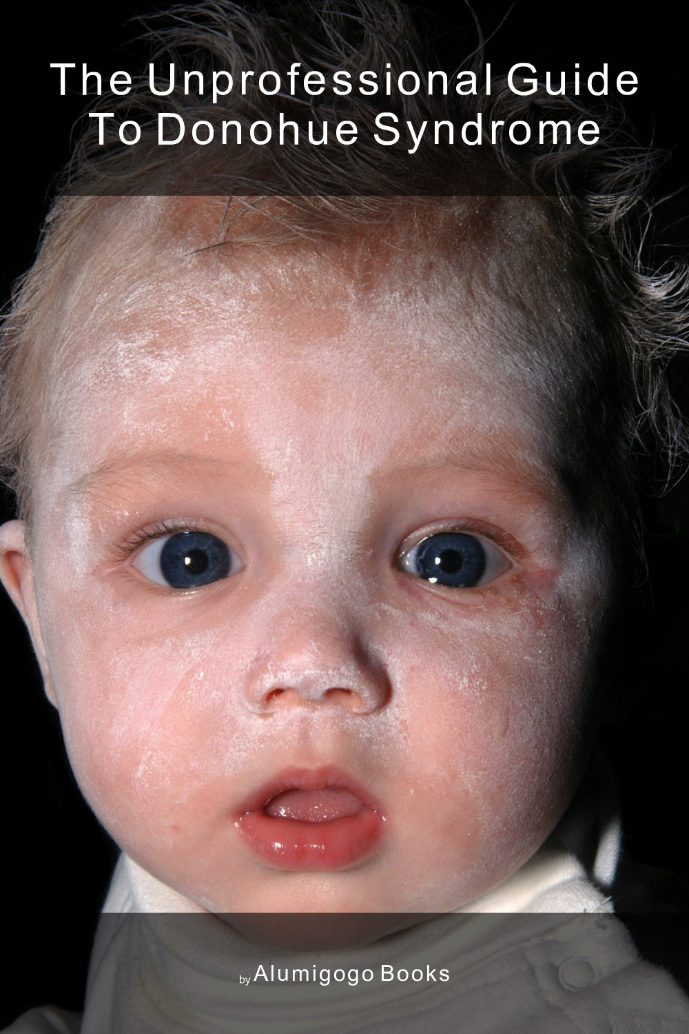 Cover of The Unprofessional Guide to Donohue syndrome