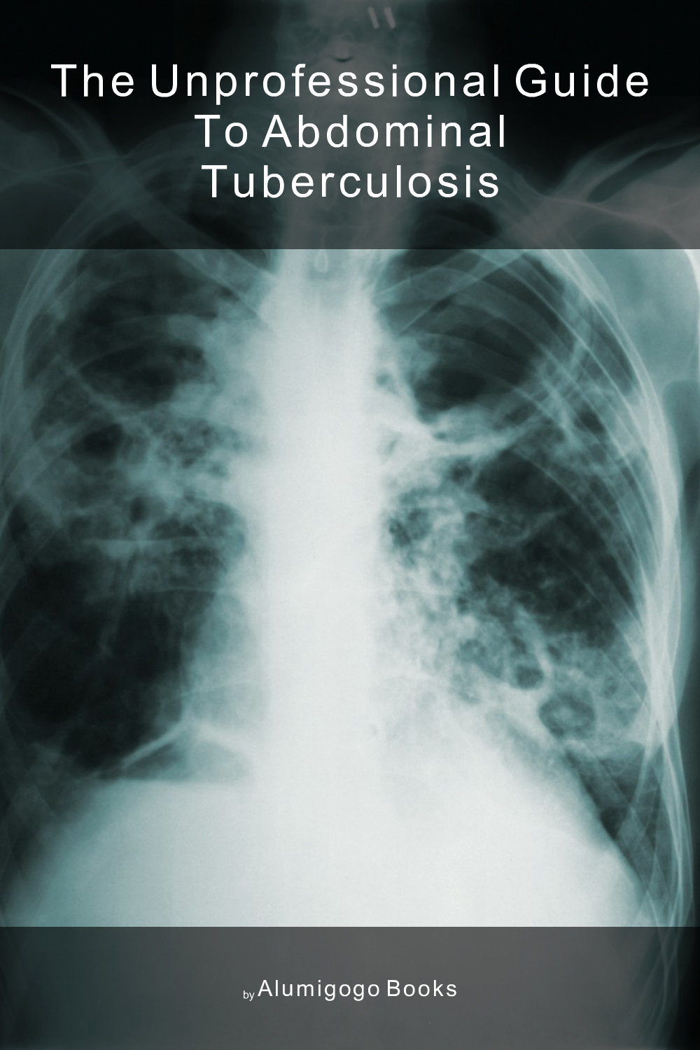 Cover of The Unprofessional Guide to abdominal tuberculosis