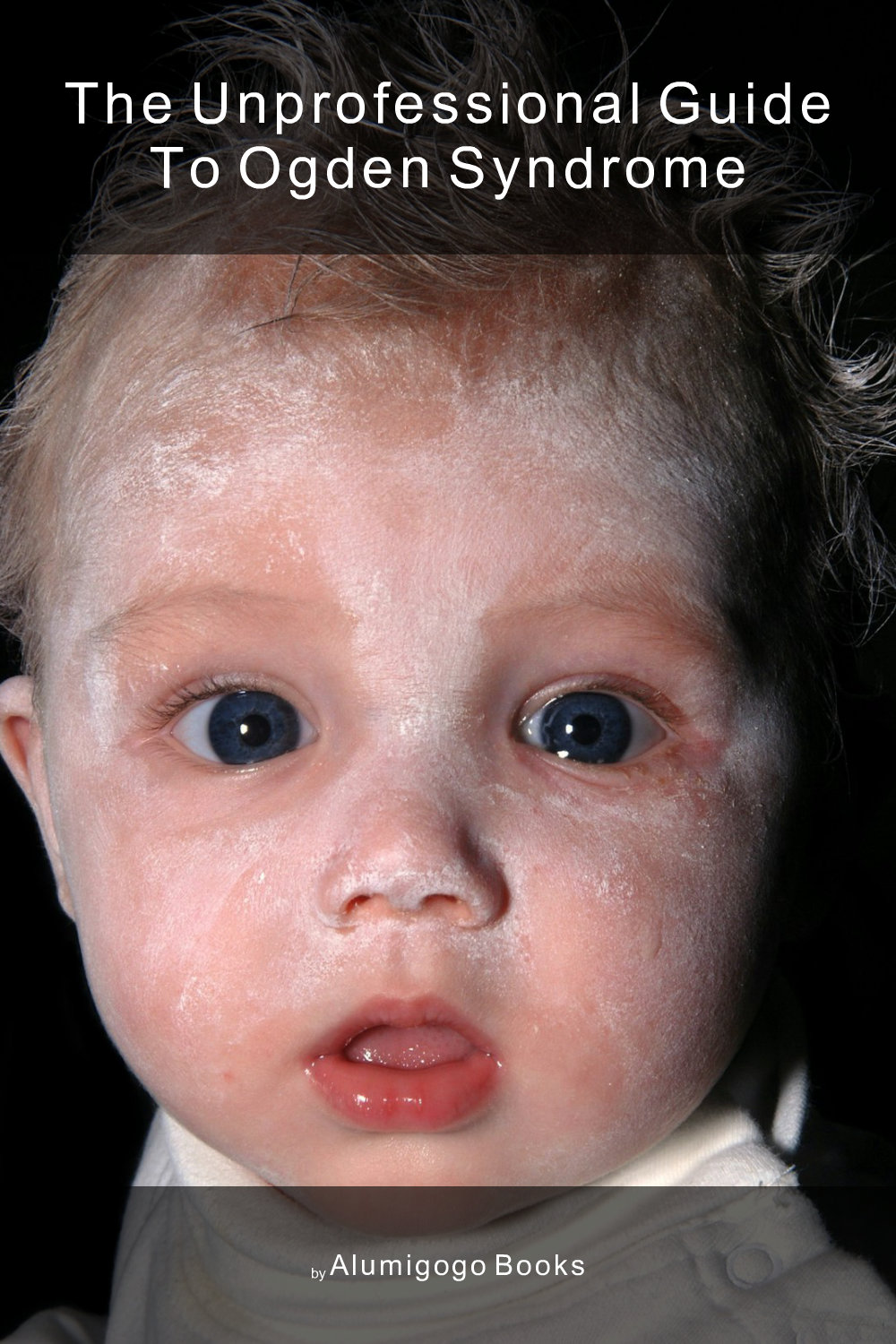 Cover of The Unprofessional Guide to Ogden syndrome