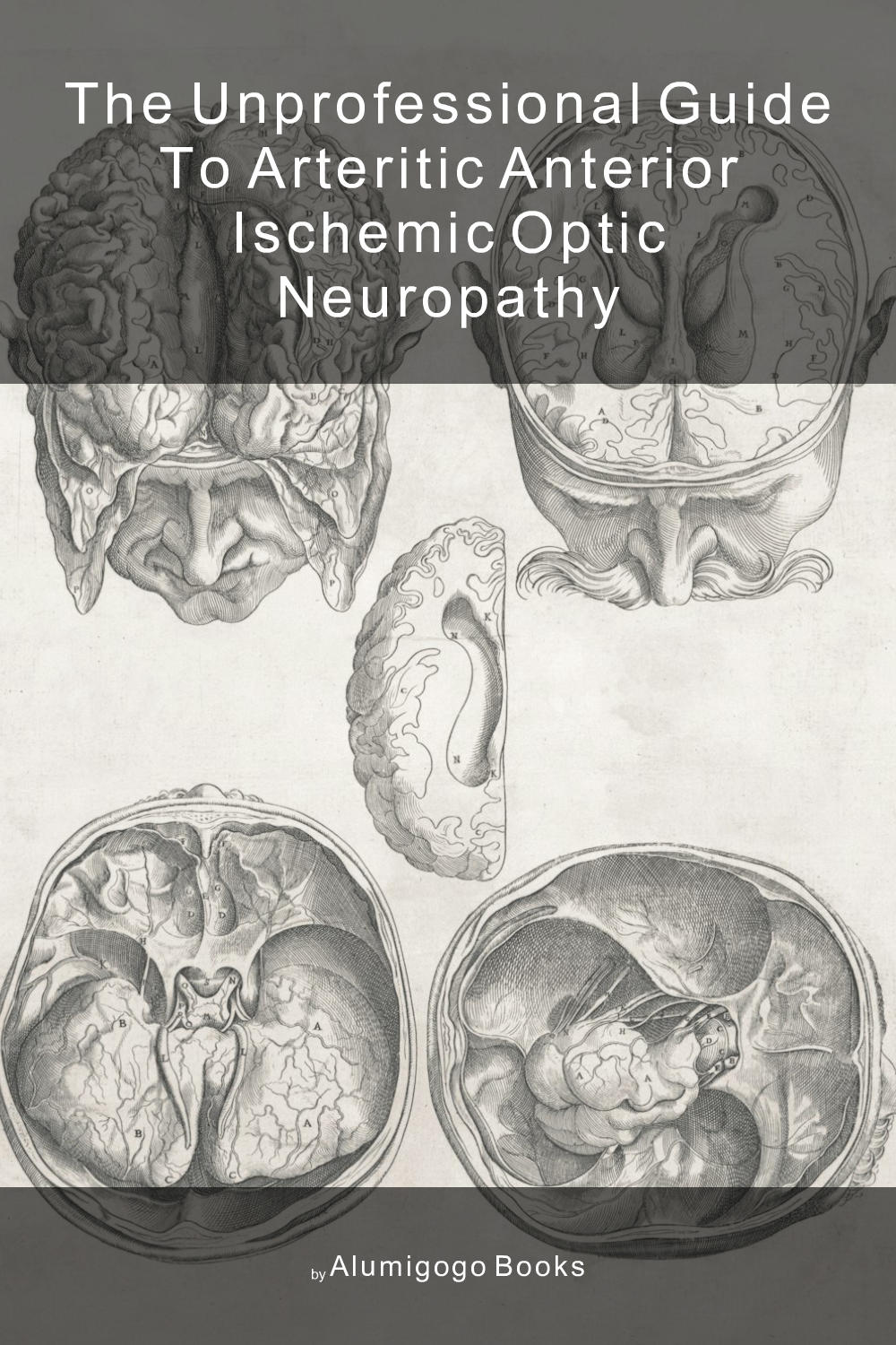 Cover of The Unprofessional Guide to arteritic anterior ischemic optic neuropathy