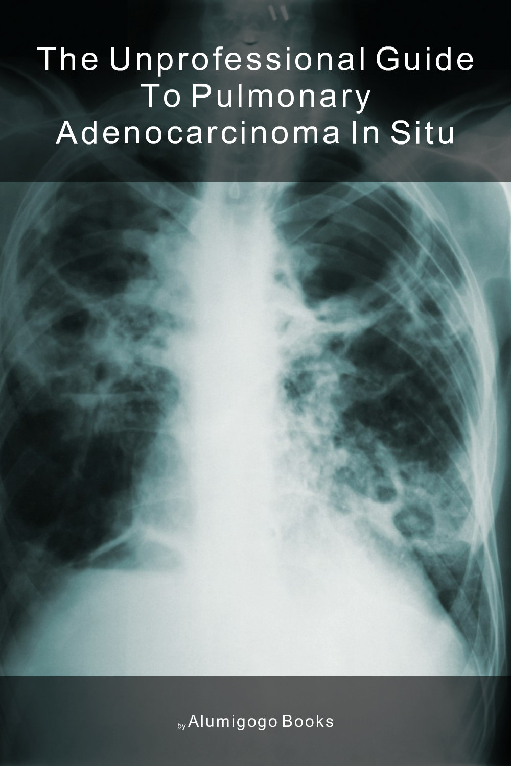 Cover of The Unprofessional Guide to pulmonary adenocarcinoma in situ
