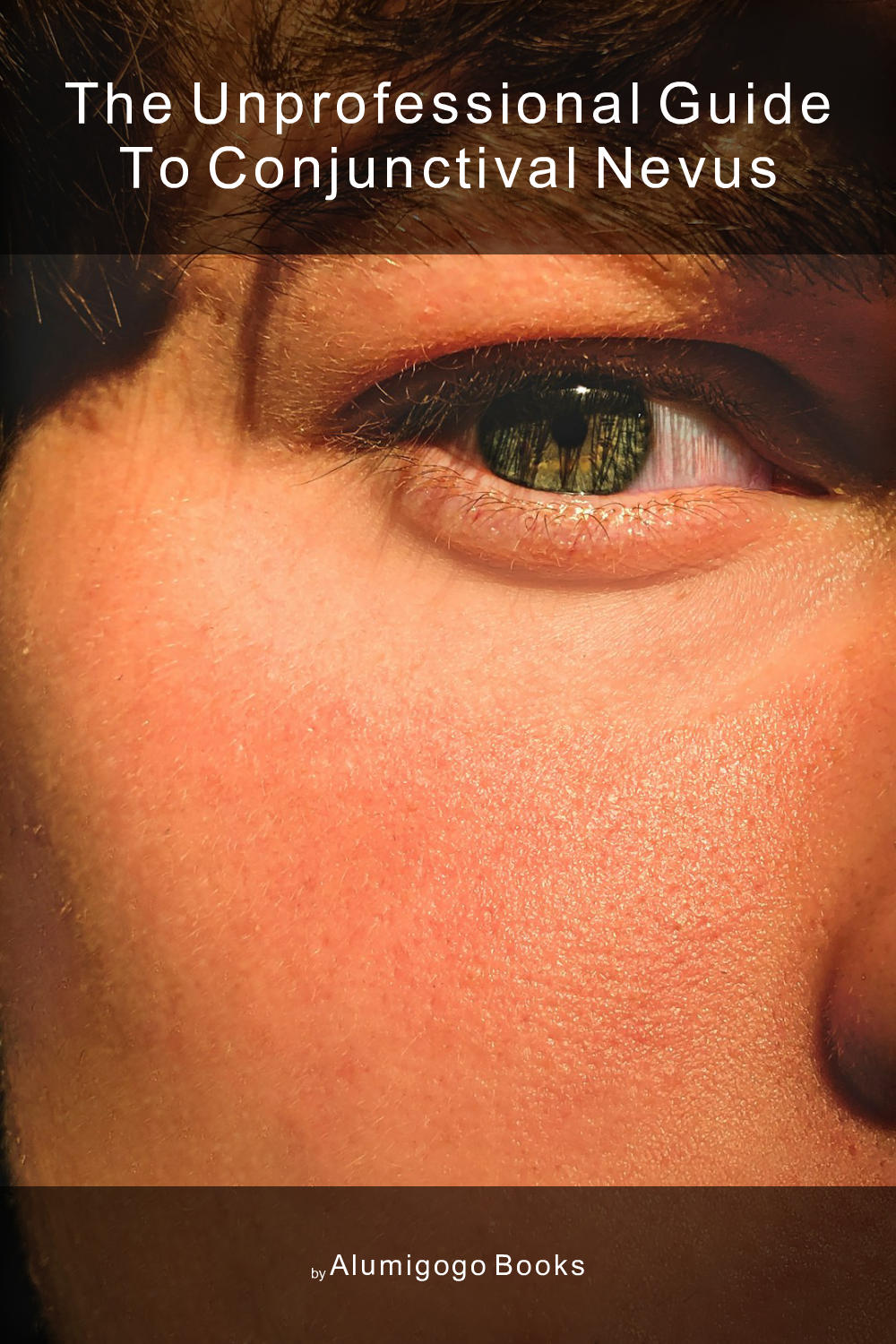 Cover of The Unprofessional Guide to conjunctival nevus