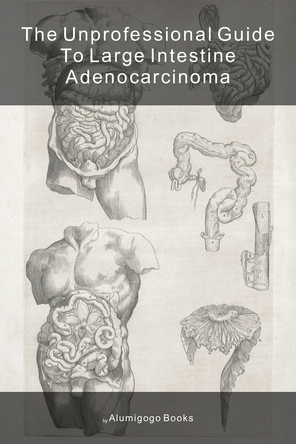 Cover of The Unprofessional Guide to large intestine adenocarcinoma