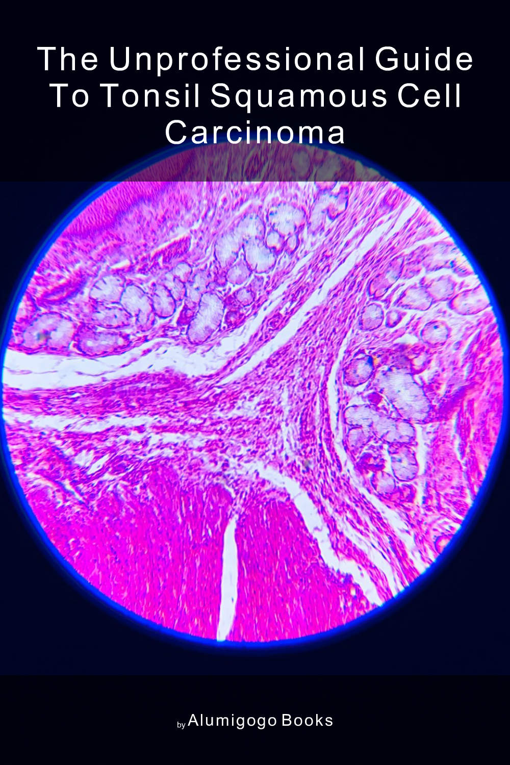 Cover of The Unprofessional Guide to tonsil squamous cell carcinoma