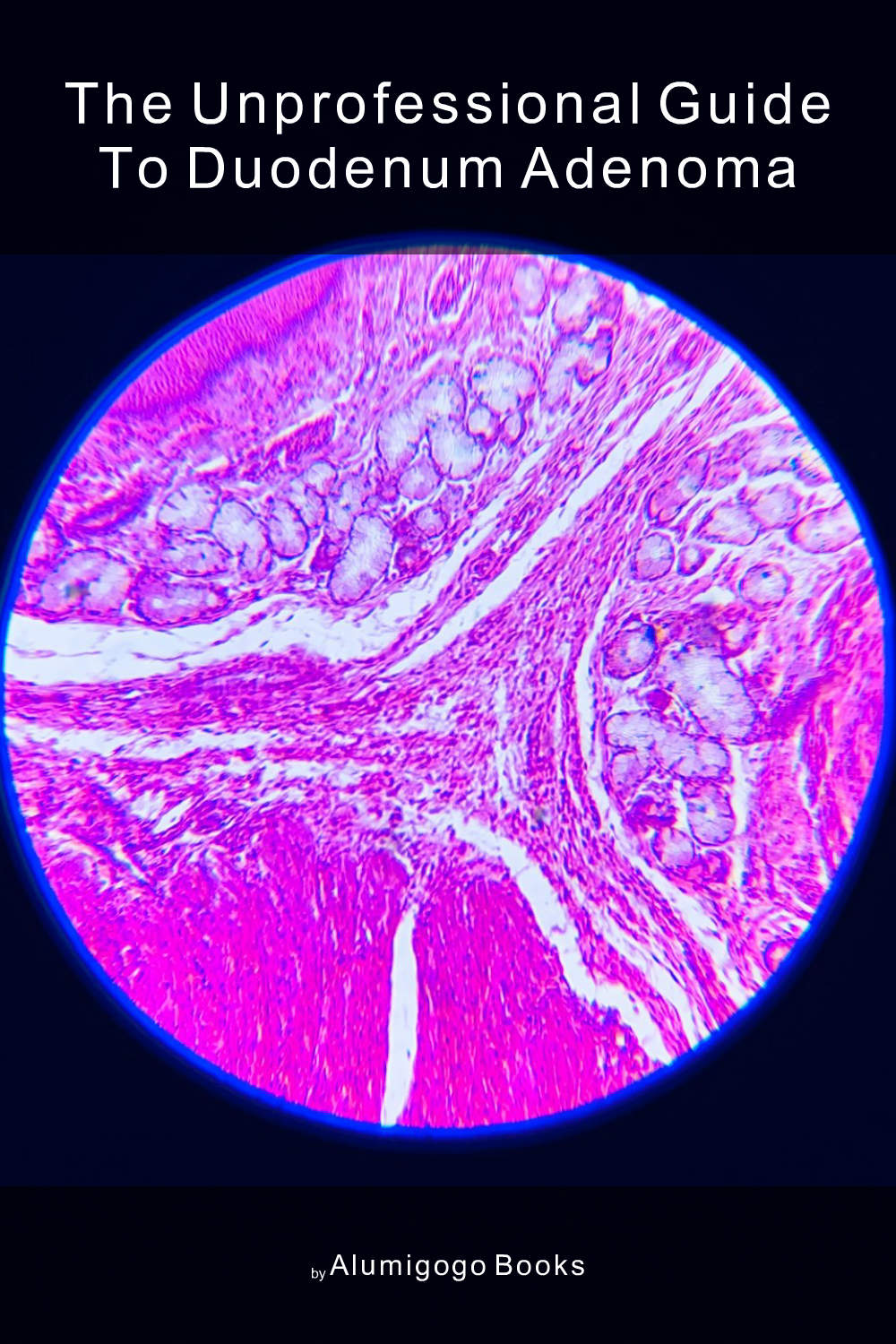 Cover of The Unprofessional Guide to duodenum adenoma
