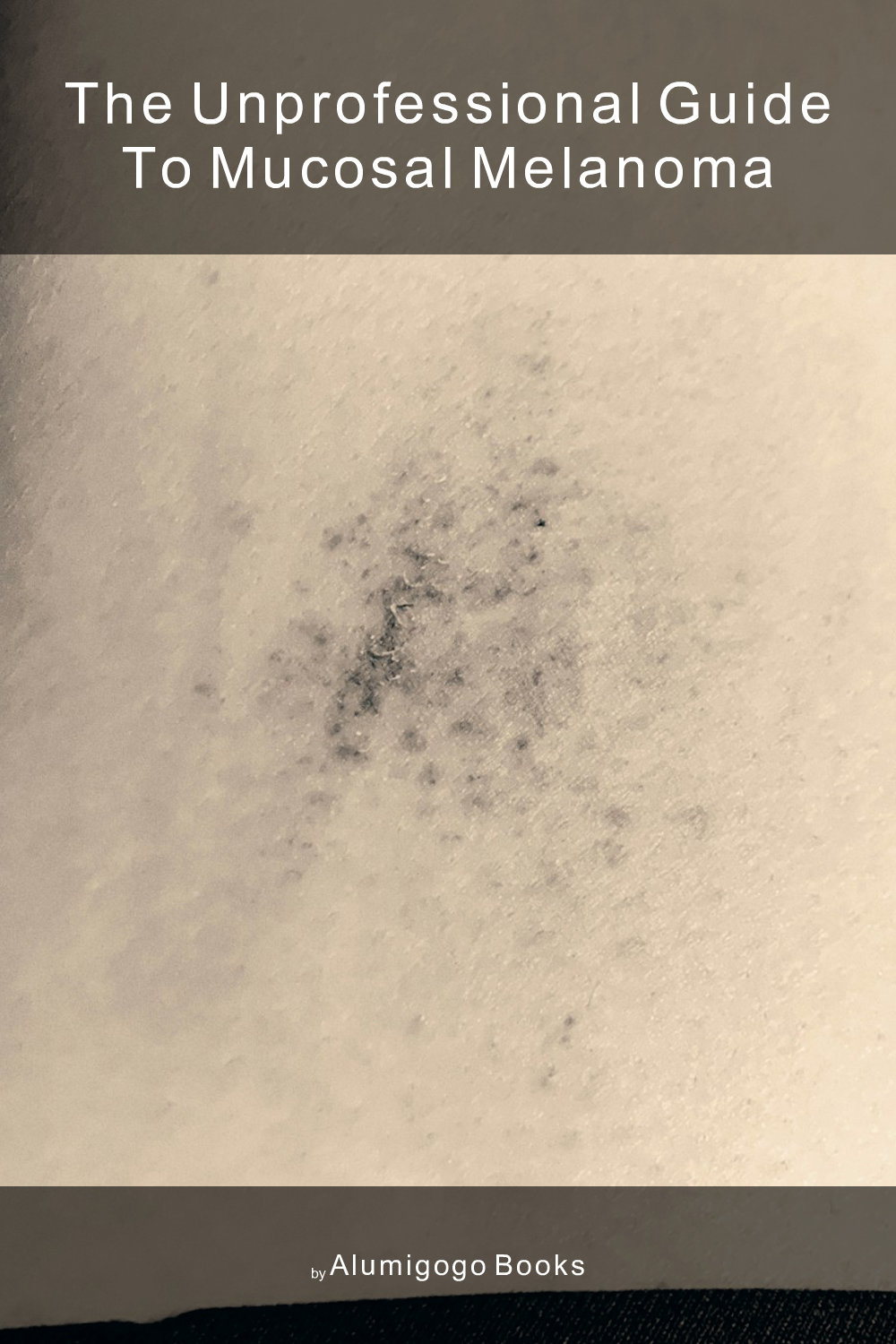 Cover of The Unprofessional Guide to mucosal melanoma