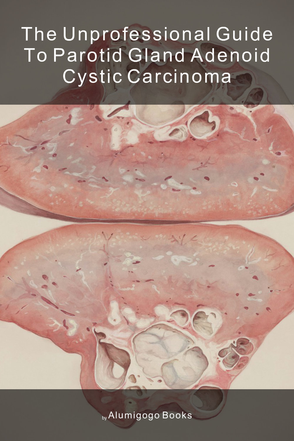 Cover of The Unprofessional Guide to parotid gland adenoid cystic carcinoma