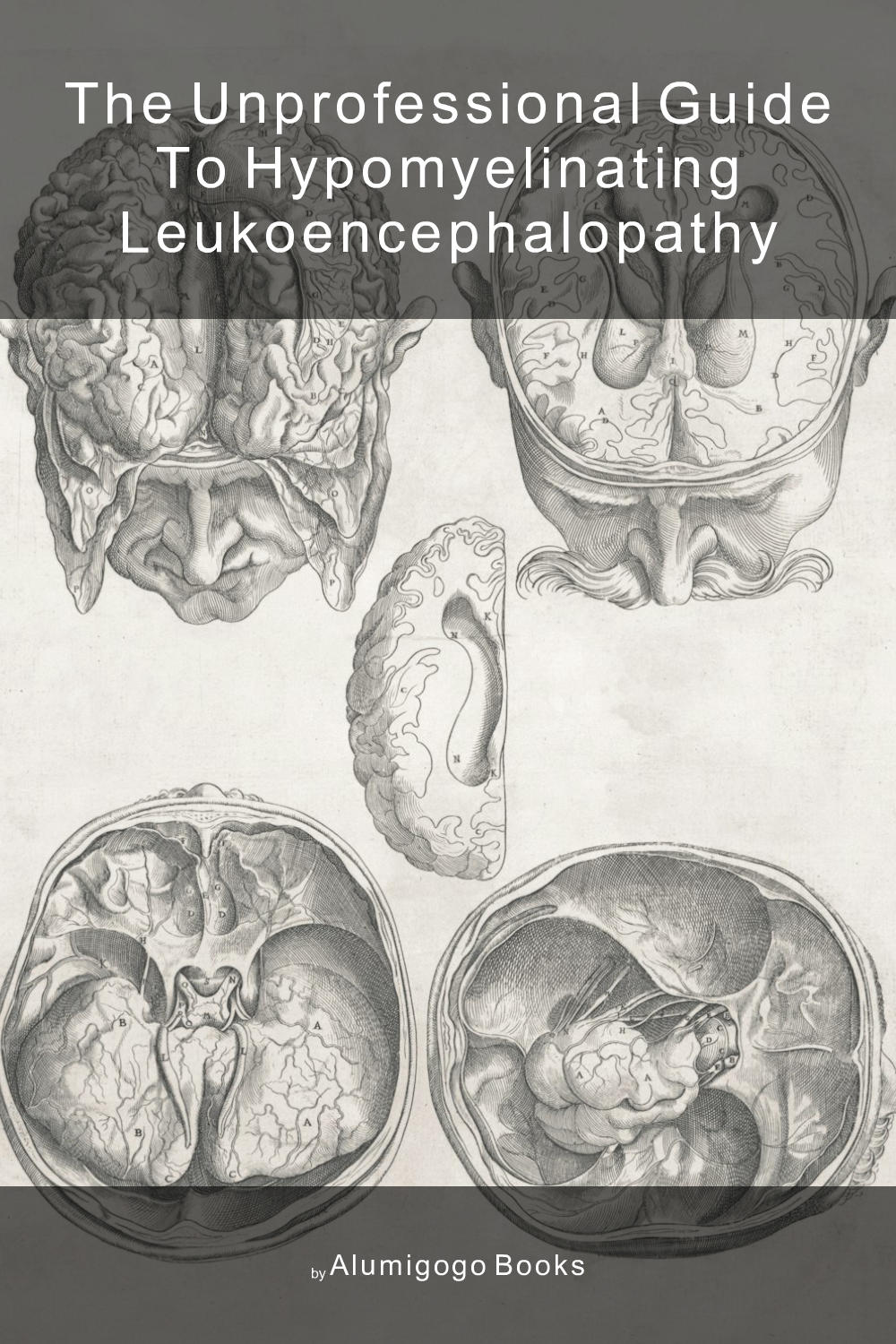 Cover of The Unprofessional Guide to hypomyelinating leukoencephalopathy