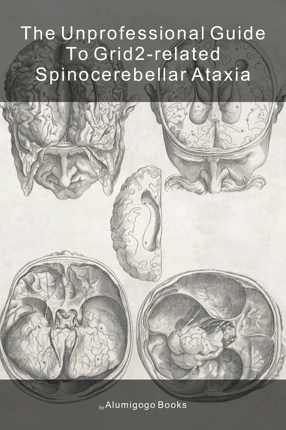 Cover of The Unprofessional Guide to GRID2-related spinocerebellar ataxia