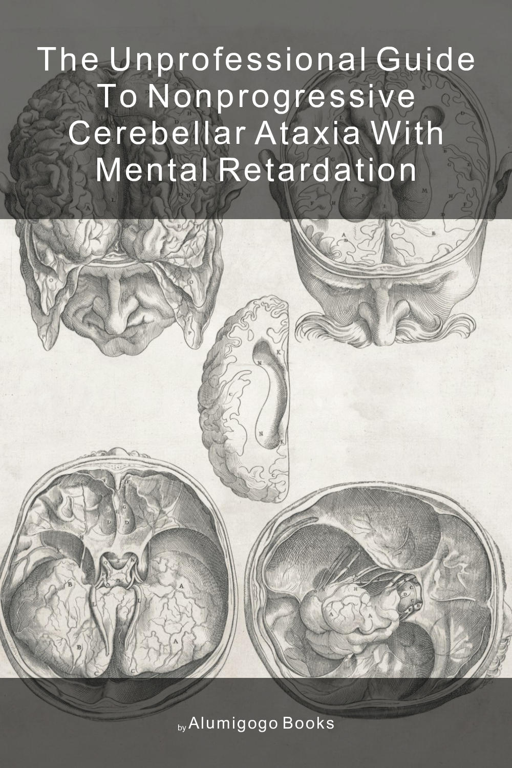 Cover of The Unprofessional Guide to nonprogressive cerebellar ataxia with mental retardation
