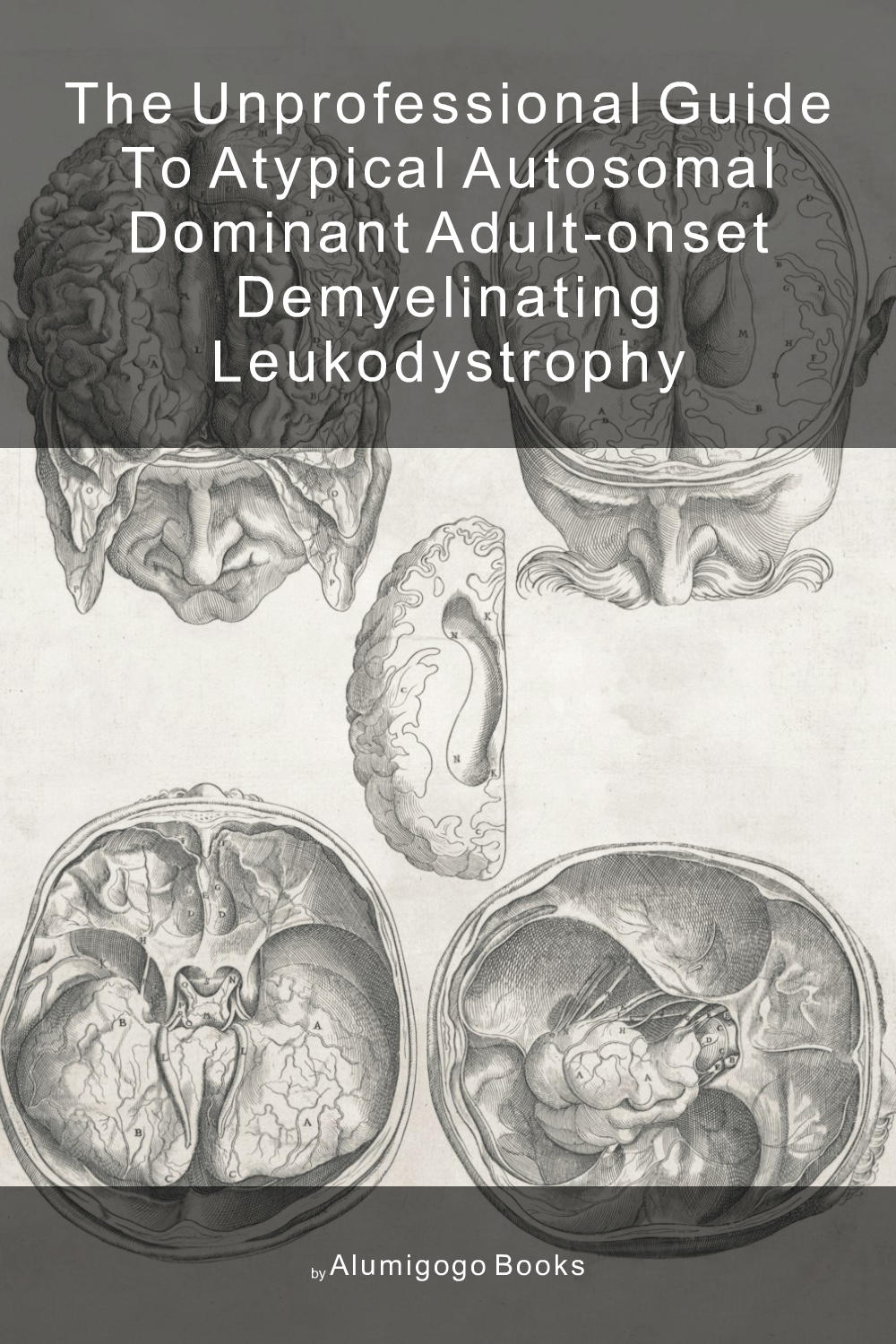 Cover of The Unprofessional Guide to atypical autosomal dominant adult-onset demyelinating leukodystrophy