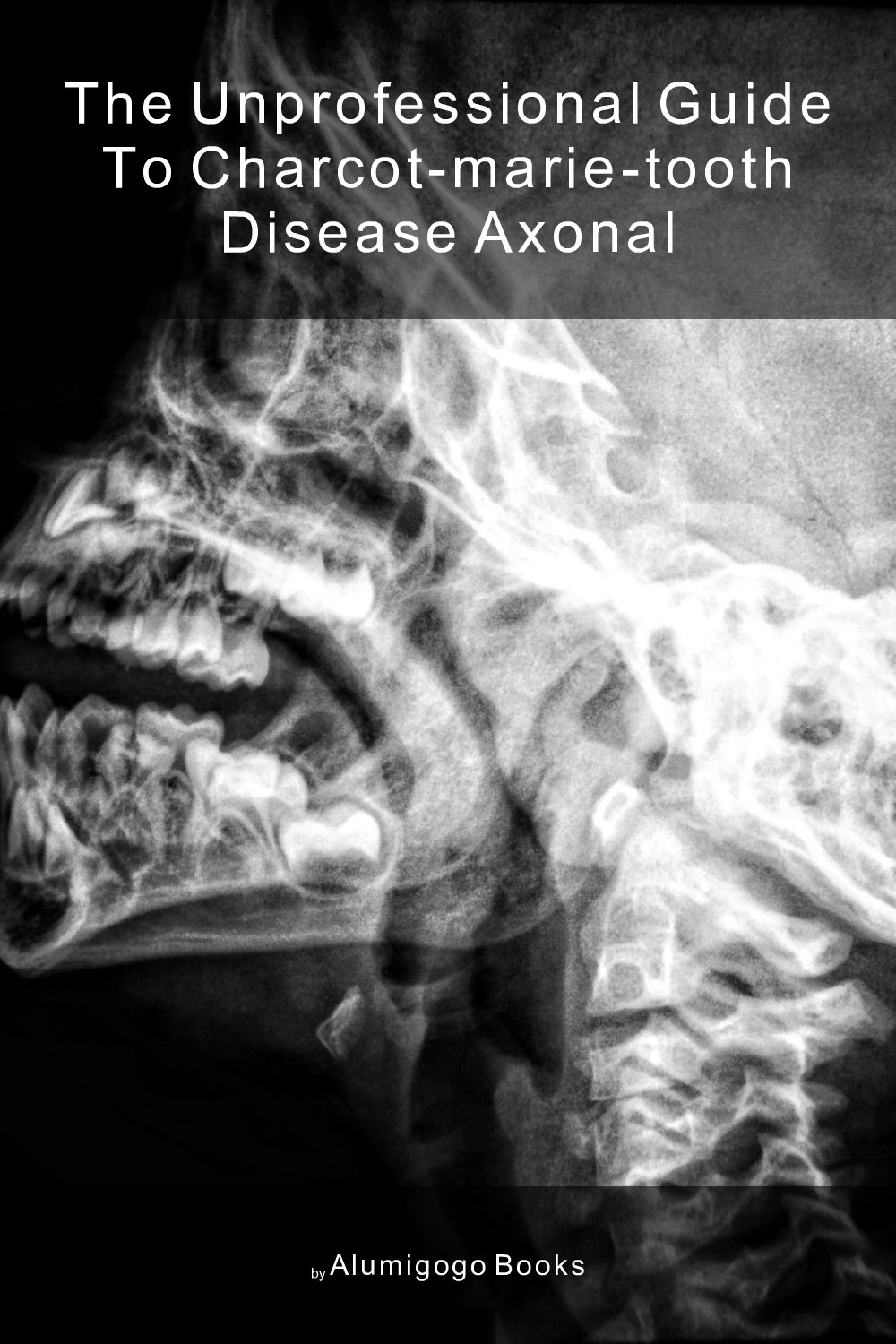 Cover of The Unprofessional Guide to Charcot-Marie-Tooth disease axonal