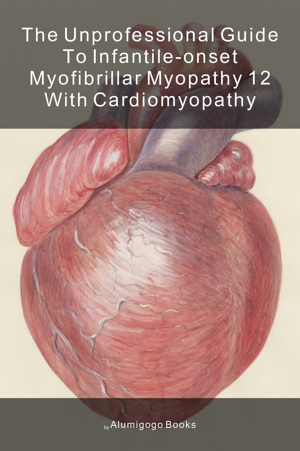 Cover of The Unprofessional Guide to infantile-onset myofibrillar myopathy 12 with cardiomyopathy