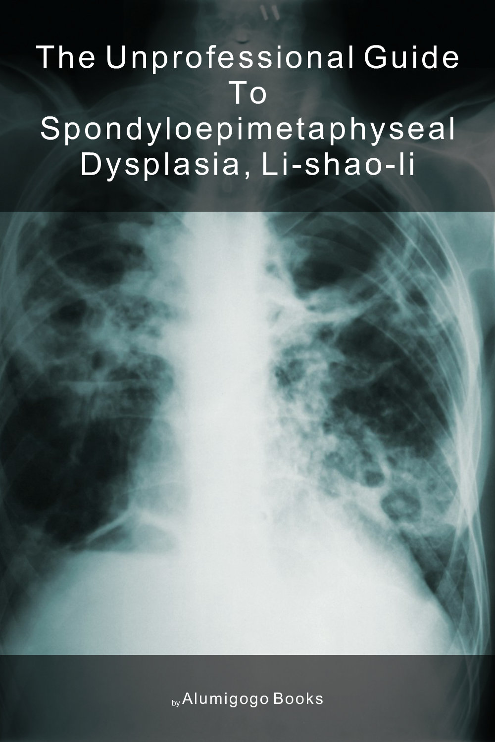 Cover of The Unprofessional Guide to spondyloepimetaphyseal dysplasia, Li-Shao-Li