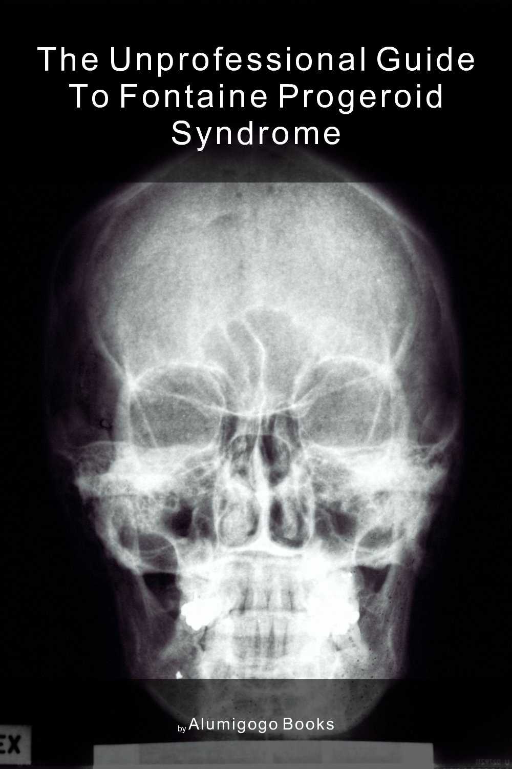 Cover of The Unprofessional Guide to Fontaine progeroid syndrome