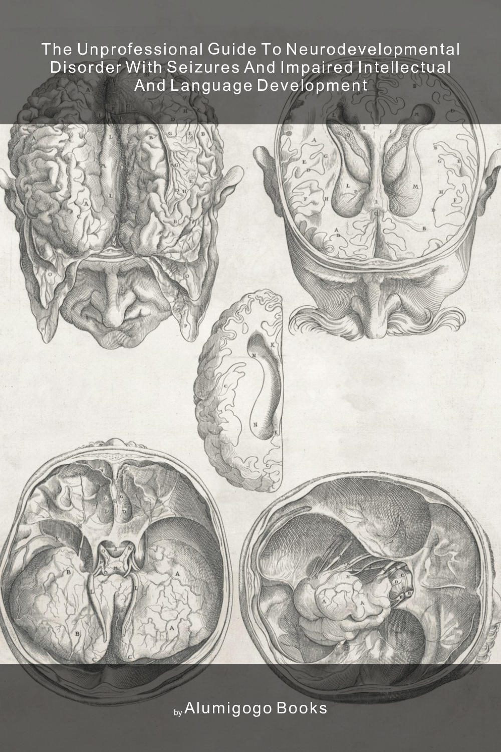 Cover of The Unprofessional Guide to neurodevelopmental disorder with seizures and impaired intellectual and language development