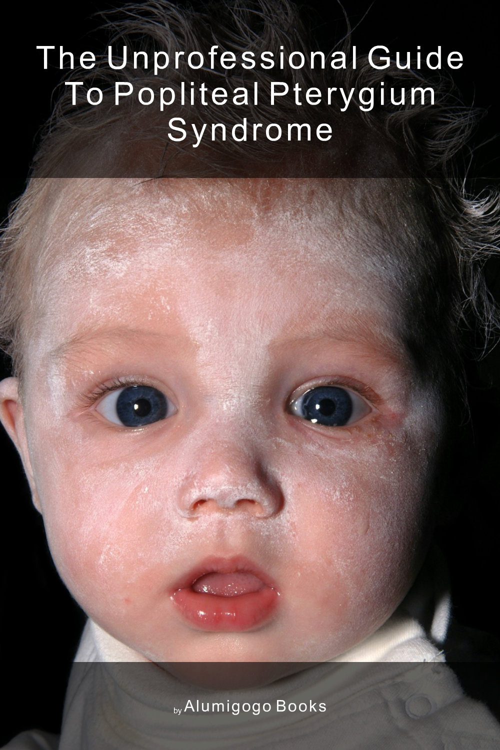 Cover of The Unprofessional Guide to popliteal pterygium syndrome