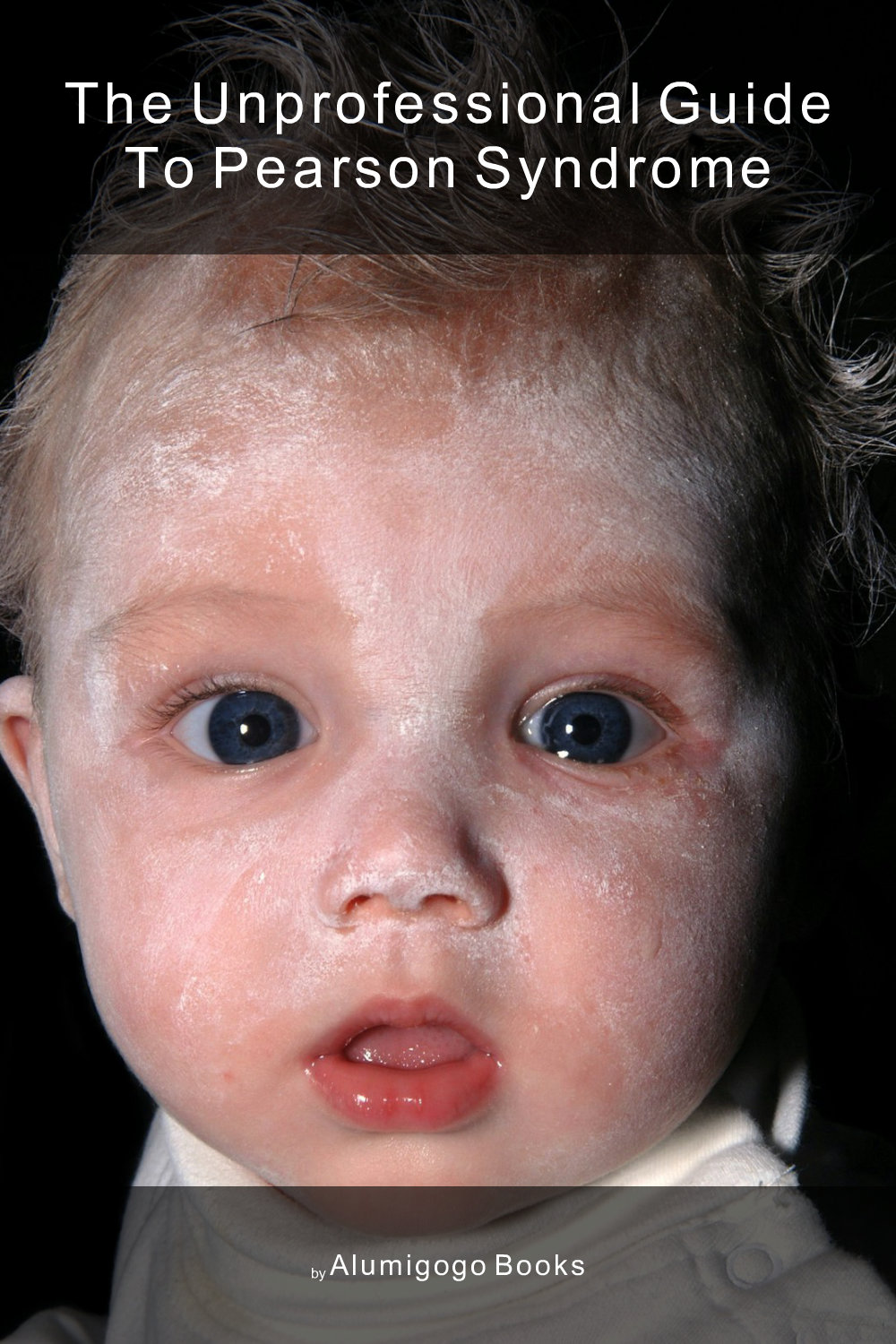 Cover of The Unprofessional Guide to Pearson syndrome