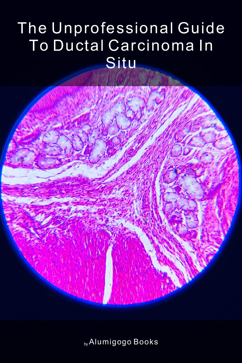Cover of The Unprofessional Guide to ductal carcinoma in situ