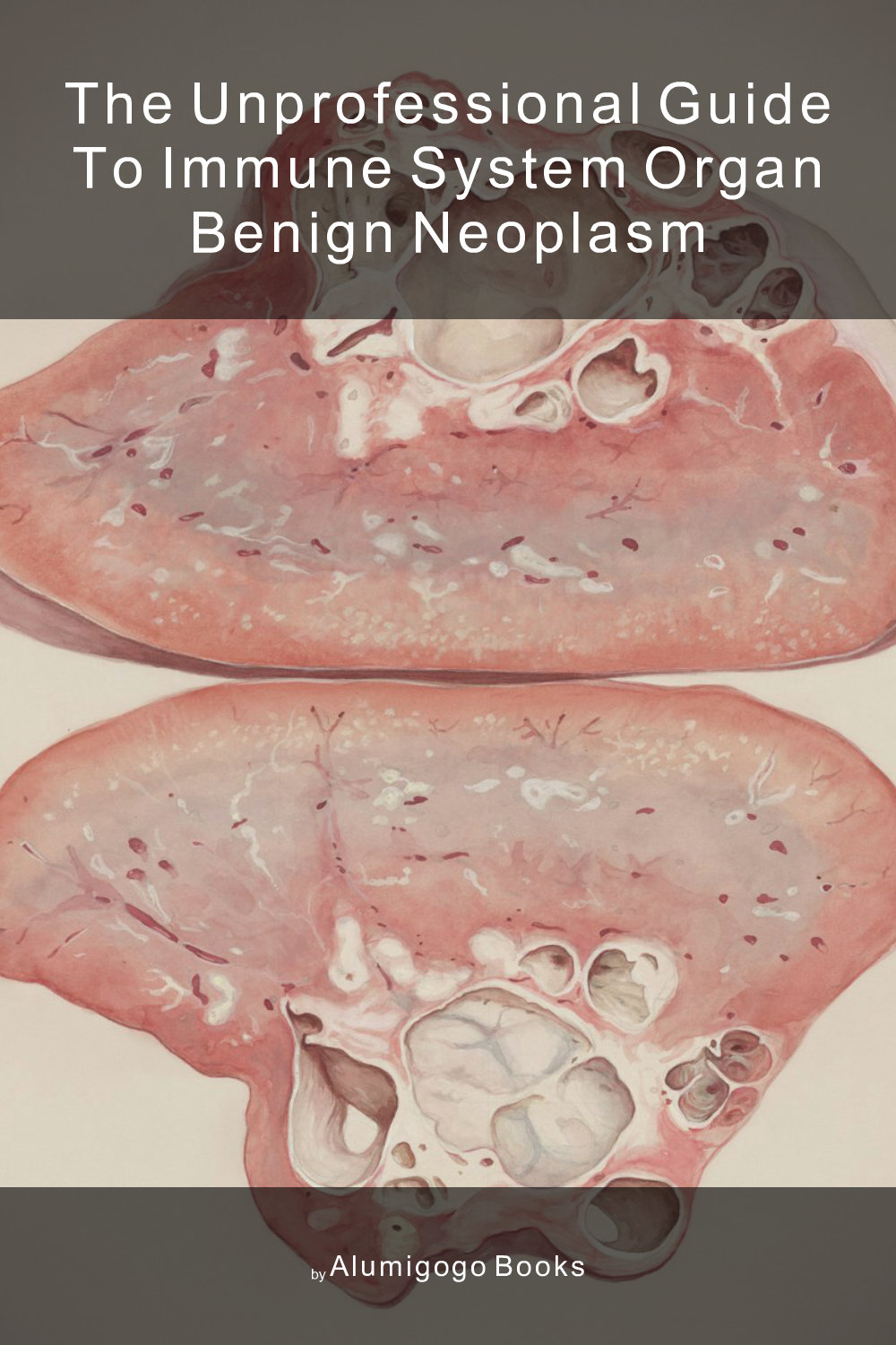 Cover of The Unprofessional Guide to immune system organ benign neoplasm
