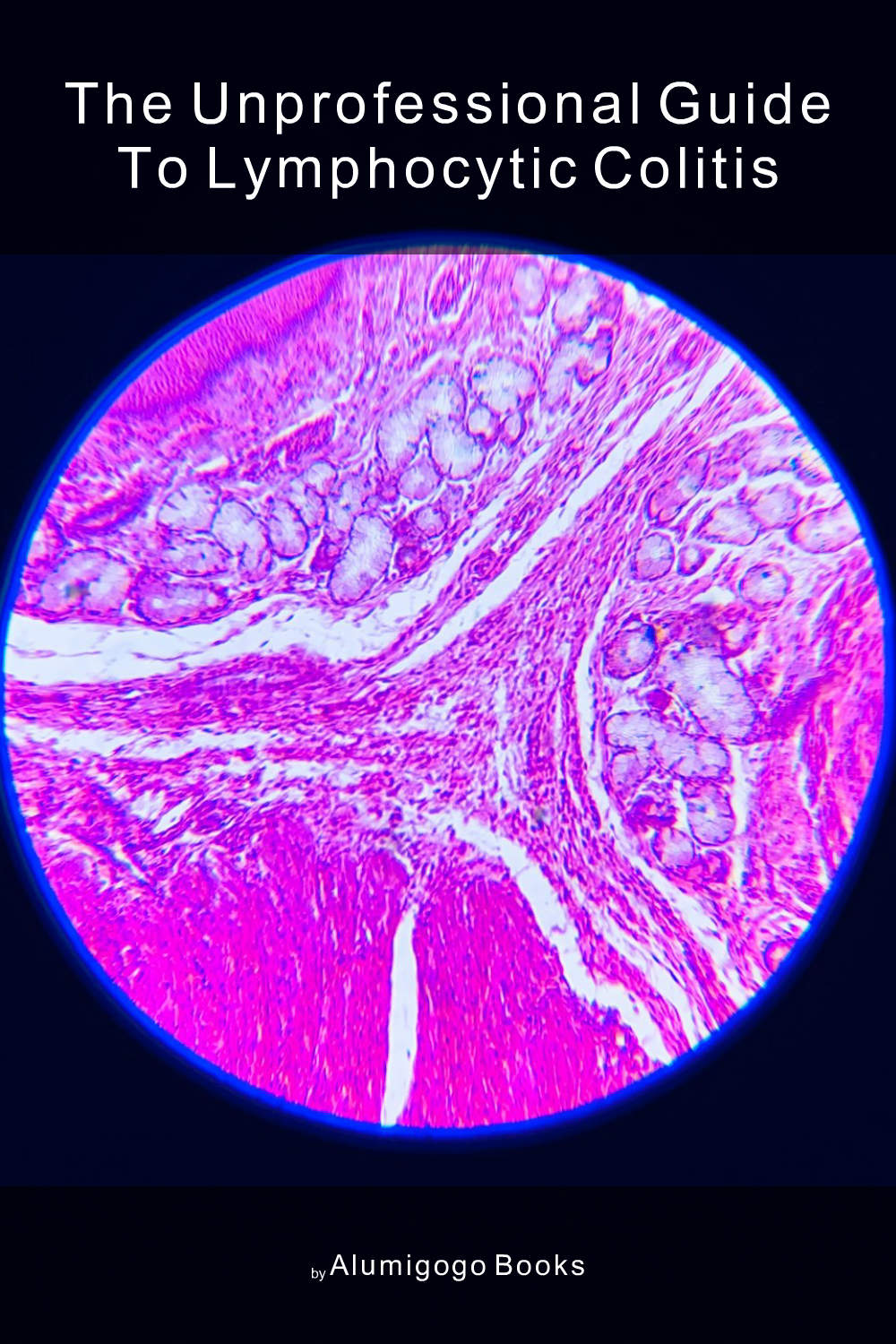 Cover of The Unprofessional Guide to lymphocytic colitis