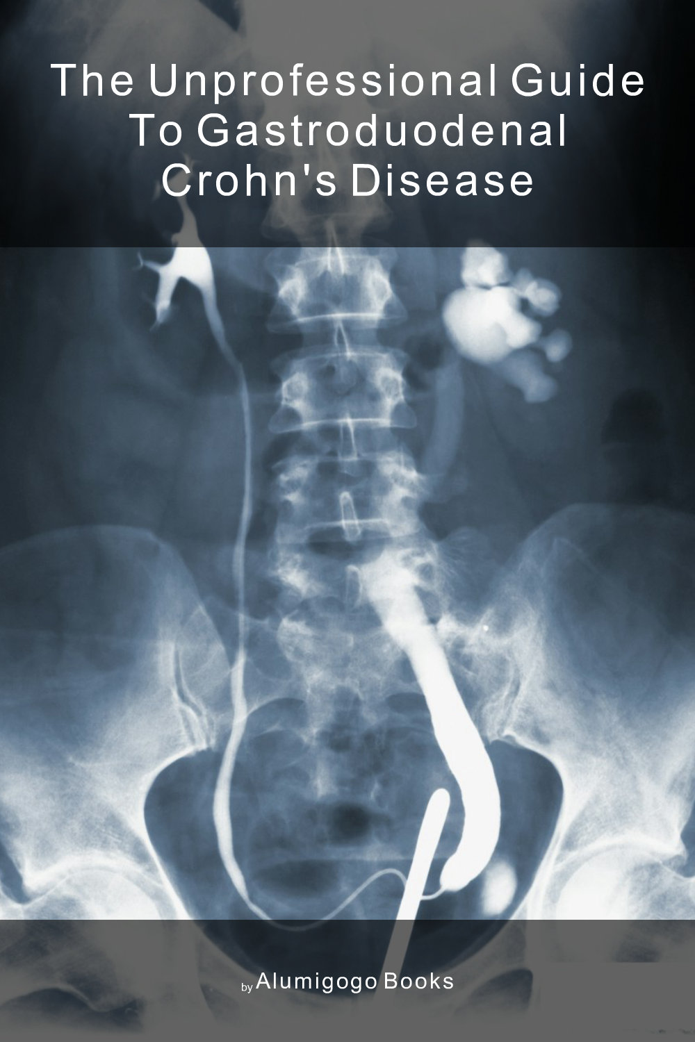 Cover of The Unprofessional Guide to gastroduodenal Crohn's disease