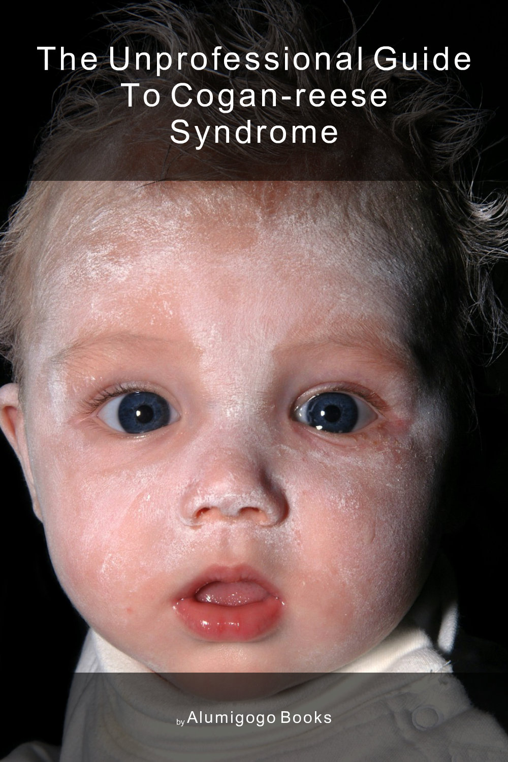 Cover of The Unprofessional Guide to Cogan-Reese syndrome