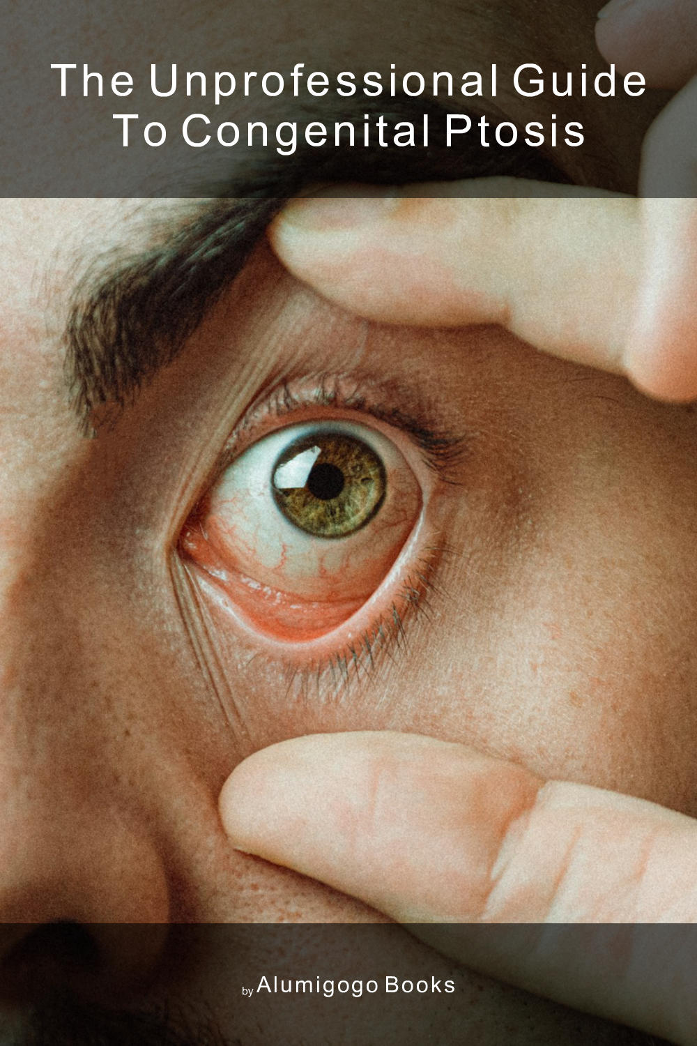 Cover of The Unprofessional Guide to congenital ptosis