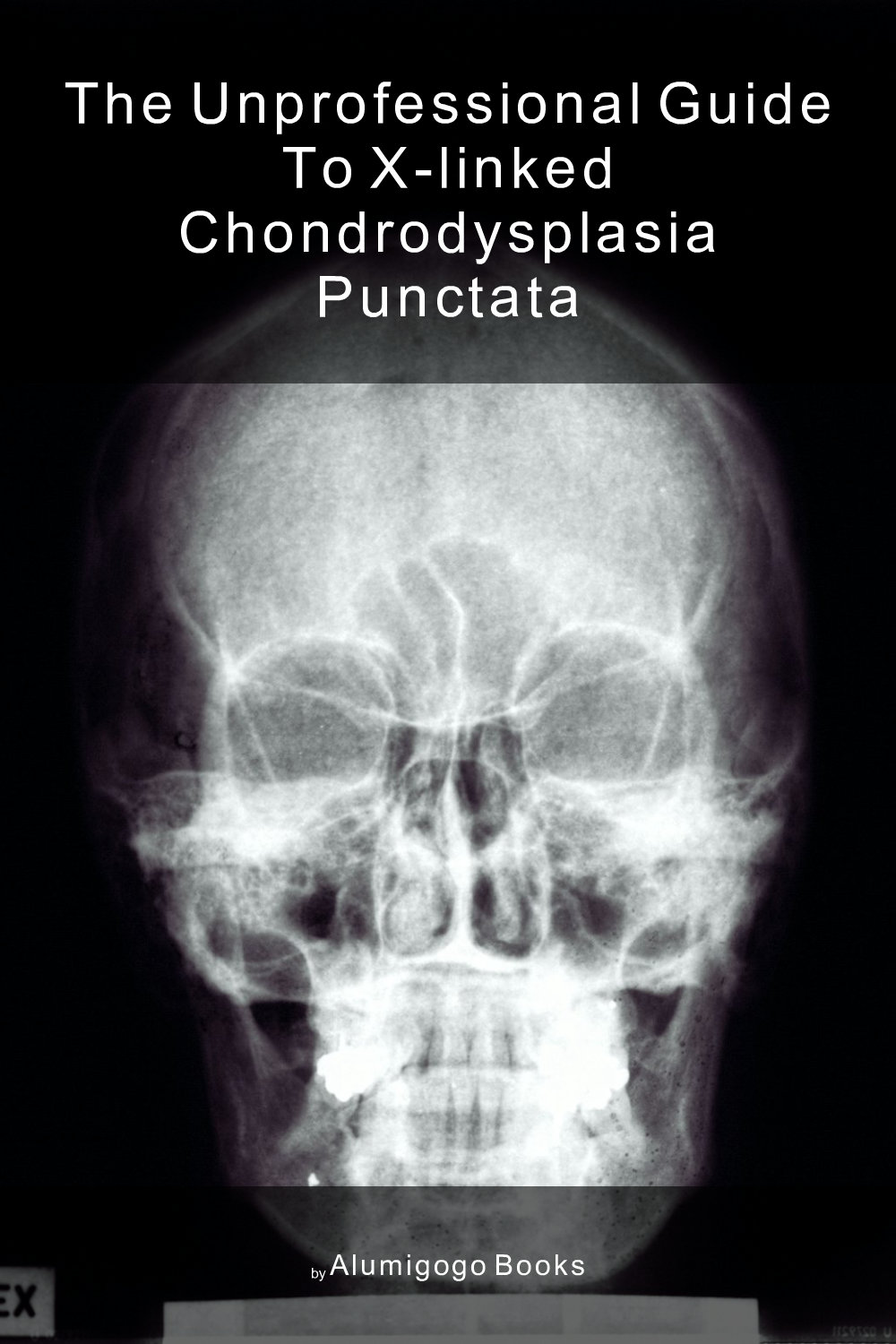 Cover of The Unprofessional Guide to X-linked chondrodysplasia punctata