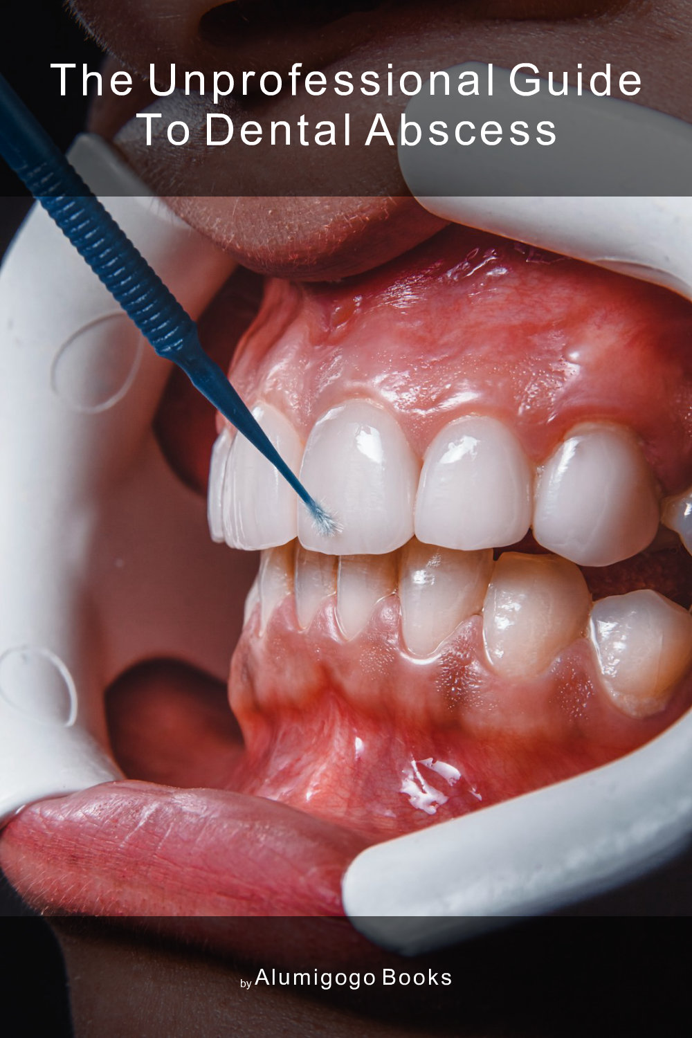 Cover of The Unprofessional Guide to dental abscess