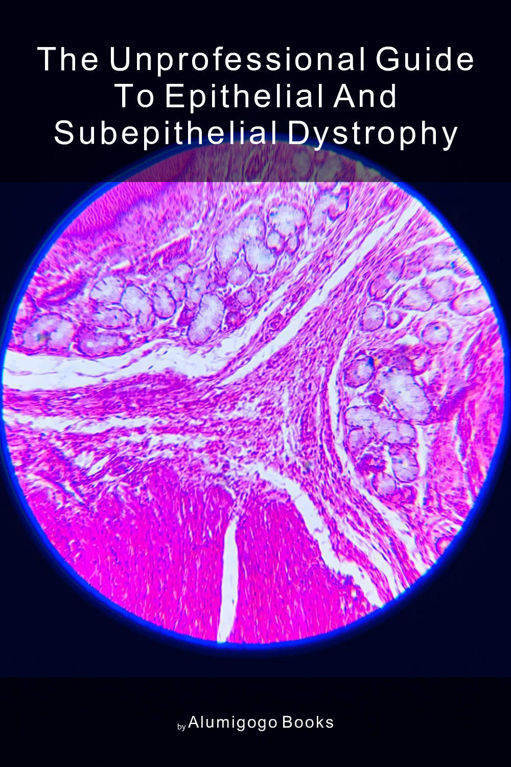 Cover of The Unprofessional Guide to epithelial and subepithelial dystrophy