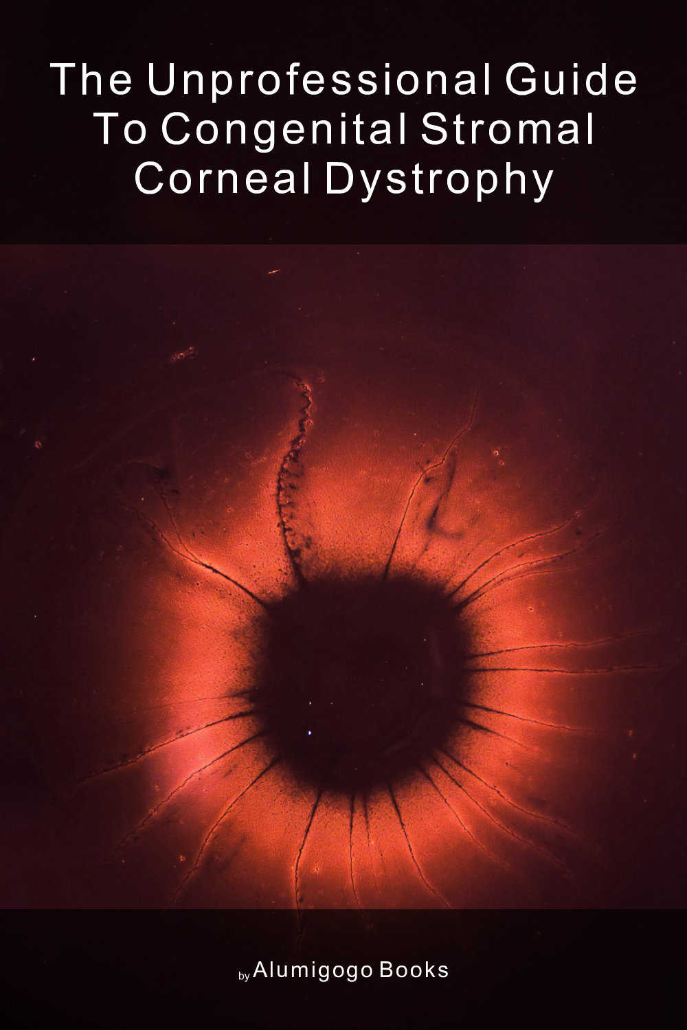 Cover of The Unprofessional Guide to congenital stromal corneal dystrophy