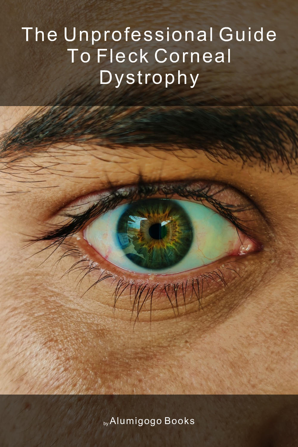 Cover of The Unprofessional Guide to Fleck corneal dystrophy