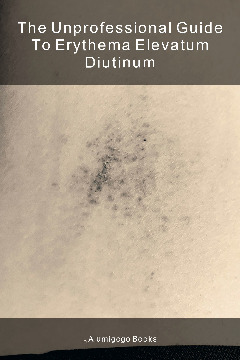 Cover of The Unprofessional Guide to erythema elevatum diutinum