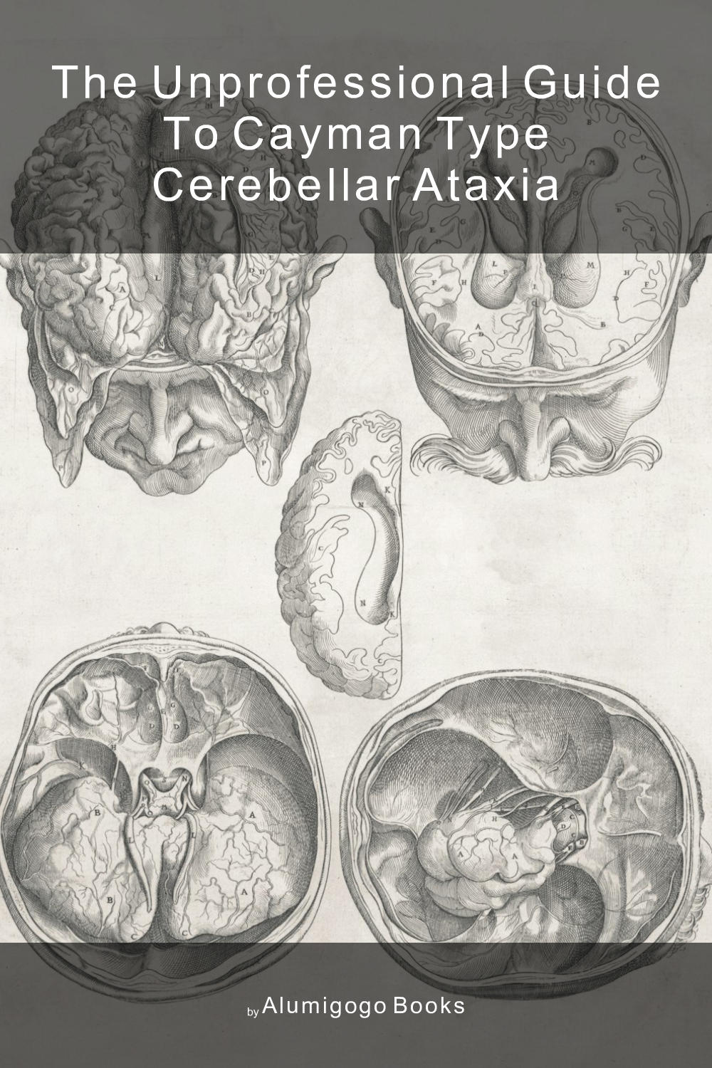 Cover of The Unprofessional Guide to Cayman type cerebellar ataxia