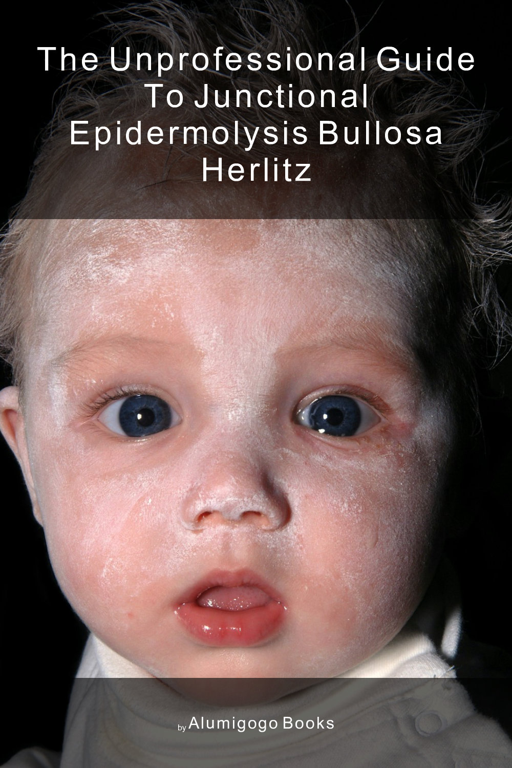 Cover of The Unprofessional Guide to junctional epidermolysis bullosa Herlitz