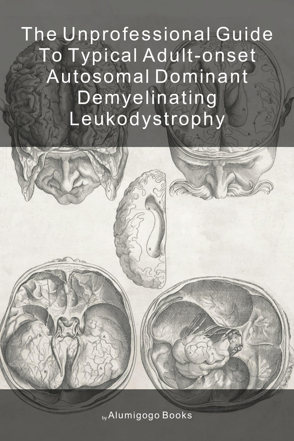 Cover of The Unprofessional Guide to typical adult-onset autosomal dominant demyelinating leukodystrophy
