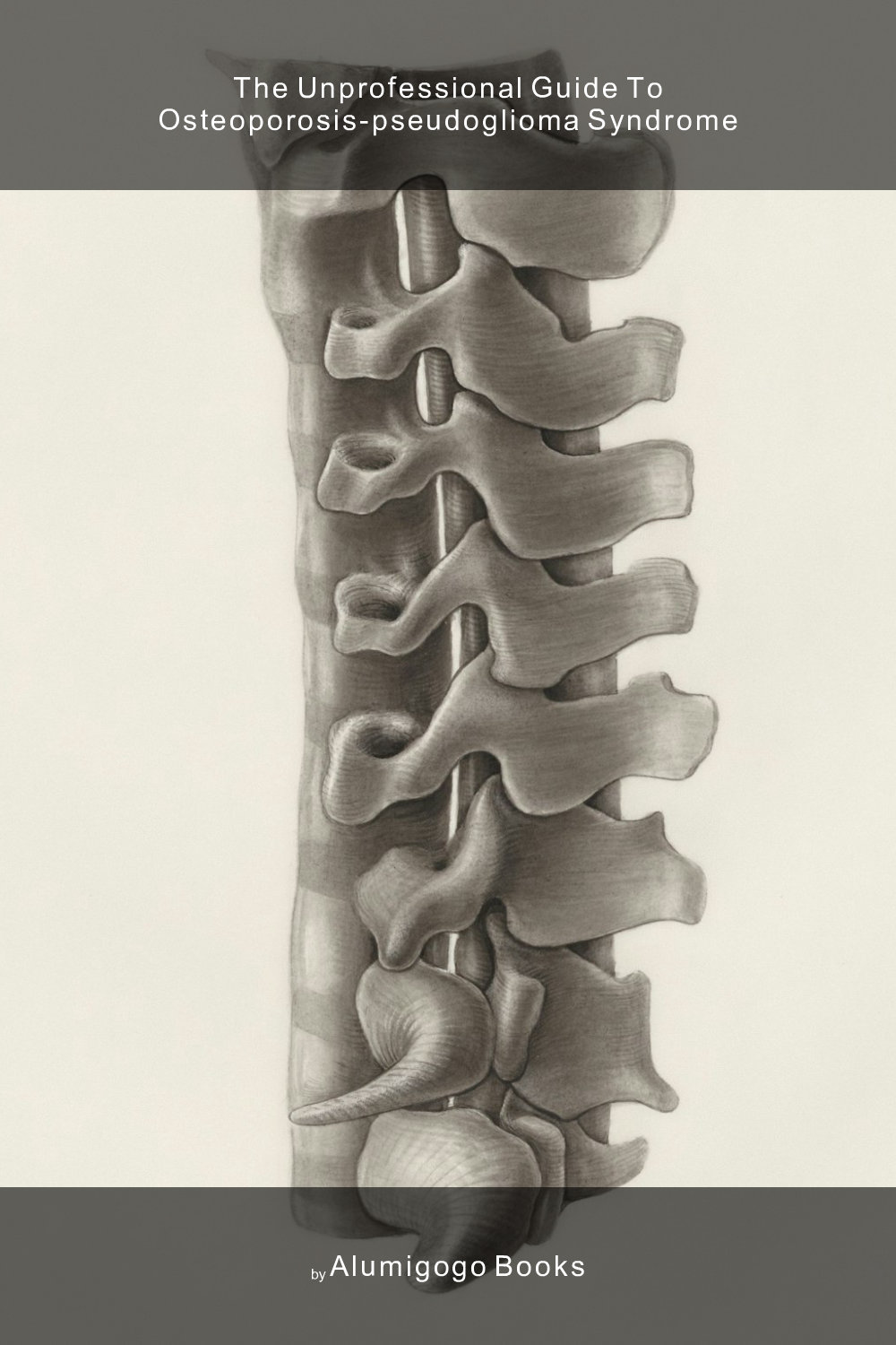 Cover of The Unprofessional Guide to osteoporosis-pseudoglioma syndrome