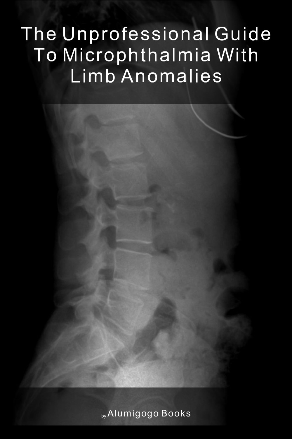 Cover of The Unprofessional Guide to microphthalmia with limb anomalies