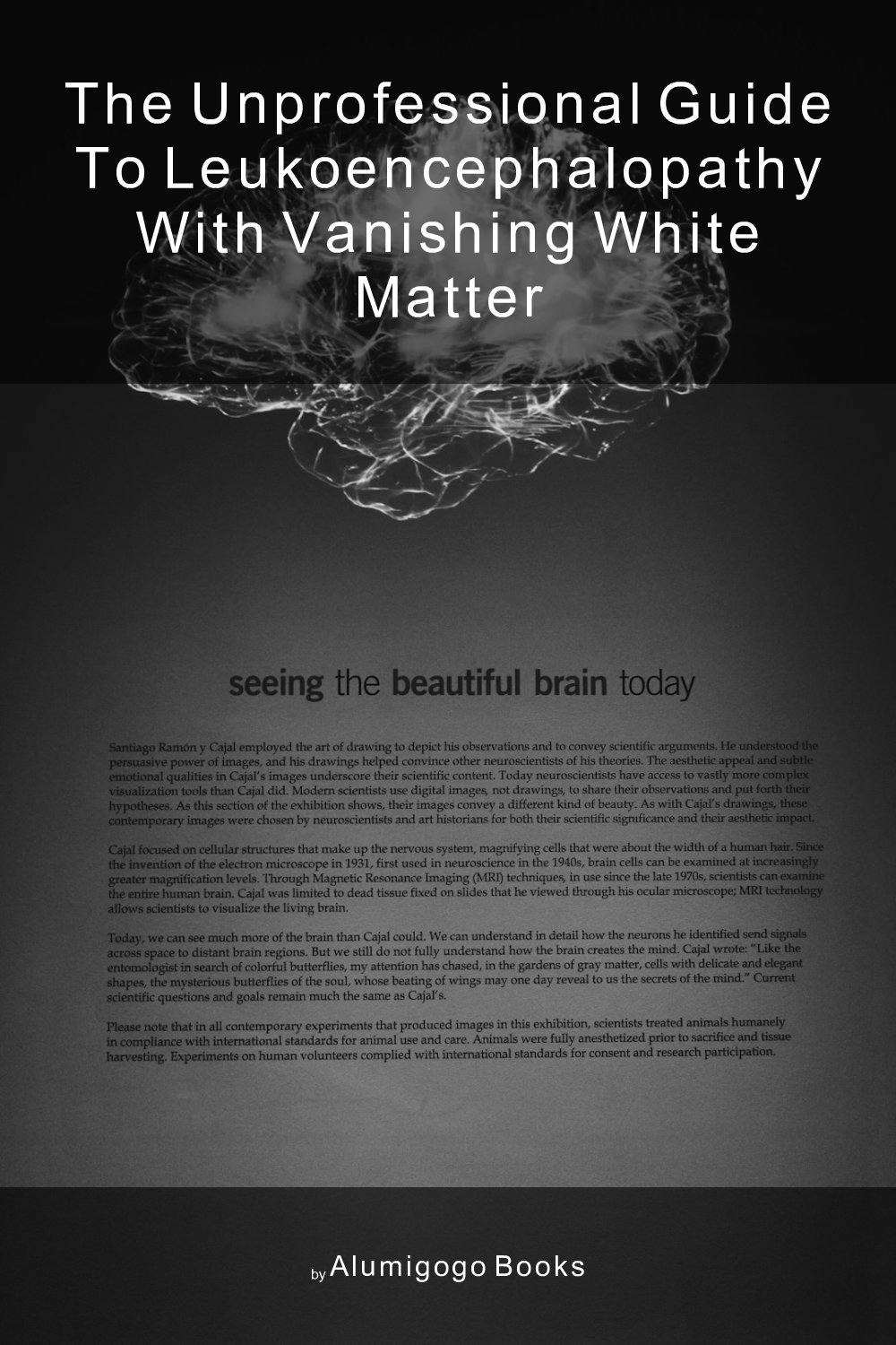 Cover of The Unprofessional Guide to leukoencephalopathy with vanishing white matter