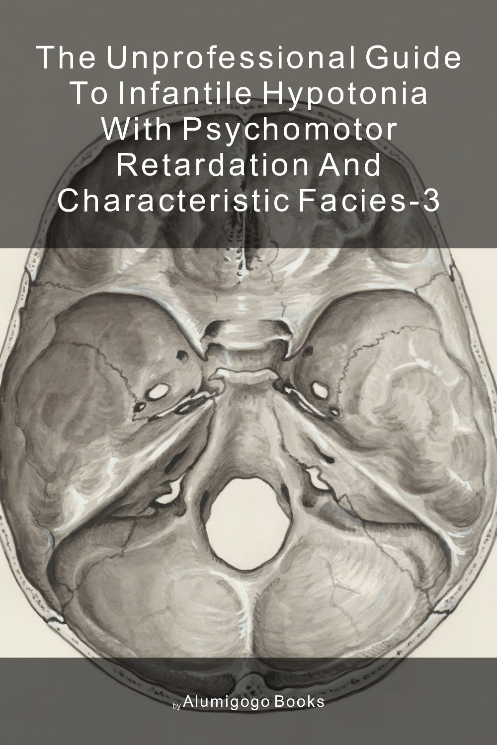 Cover of The Unprofessional Guide to infantile hypotonia with psychomotor retardation and characteristic facies-3