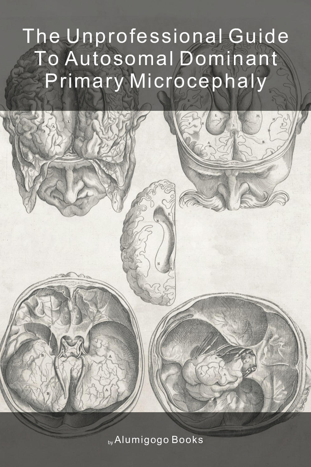 Cover of The Unprofessional Guide to autosomal dominant primary microcephaly