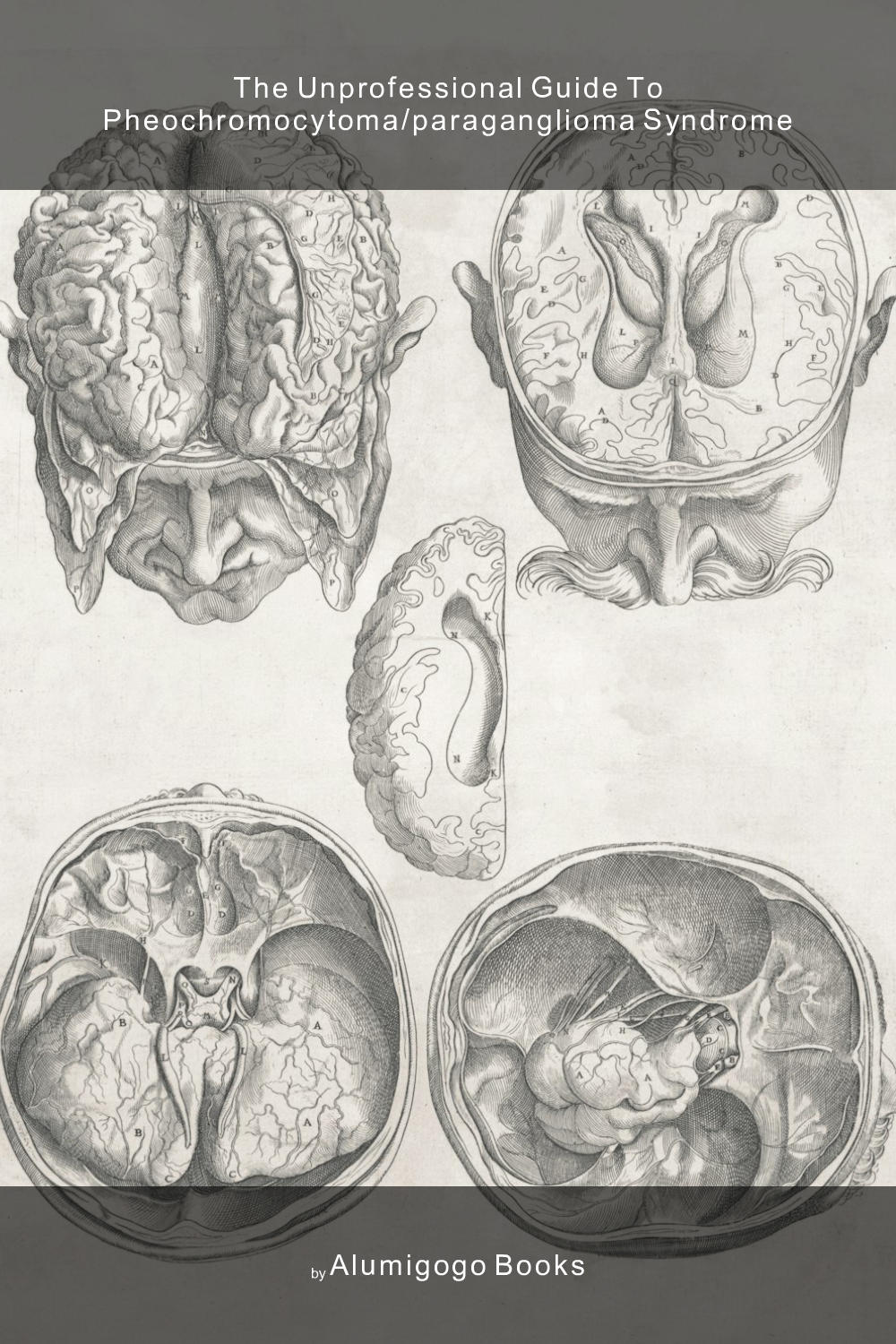 Cover of The Unprofessional Guide to pheochromocytoma/paraganglioma syndrome