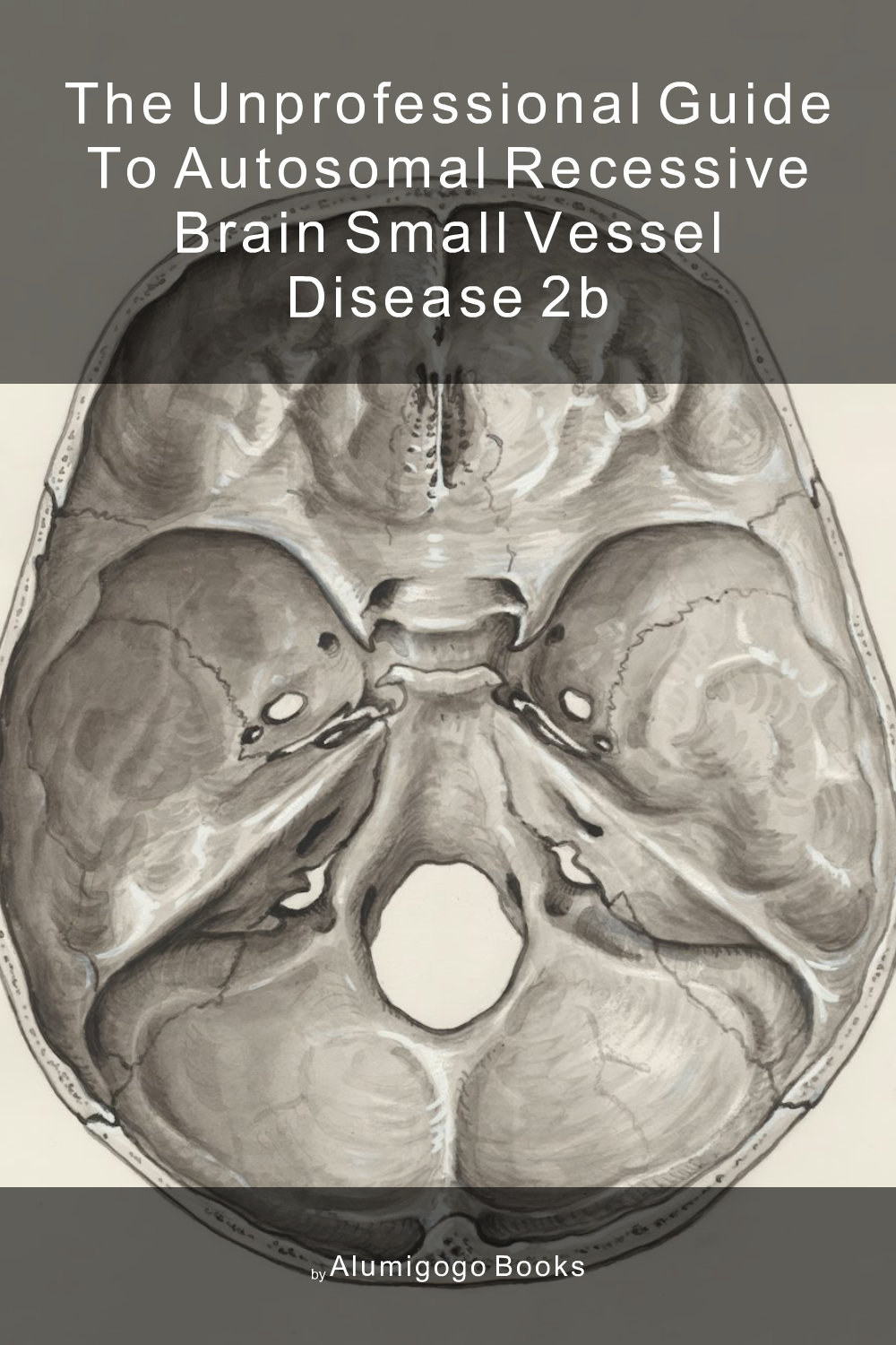 Cover of The Unprofessional Guide to autosomal recessive brain small vessel disease 2B