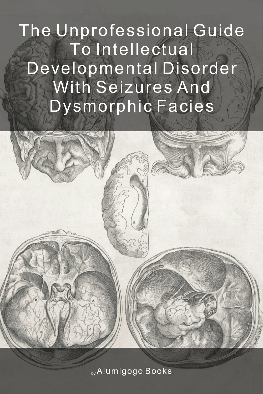 Cover of The Unprofessional Guide to intellectual developmental disorder with seizures and dysmorphic facies