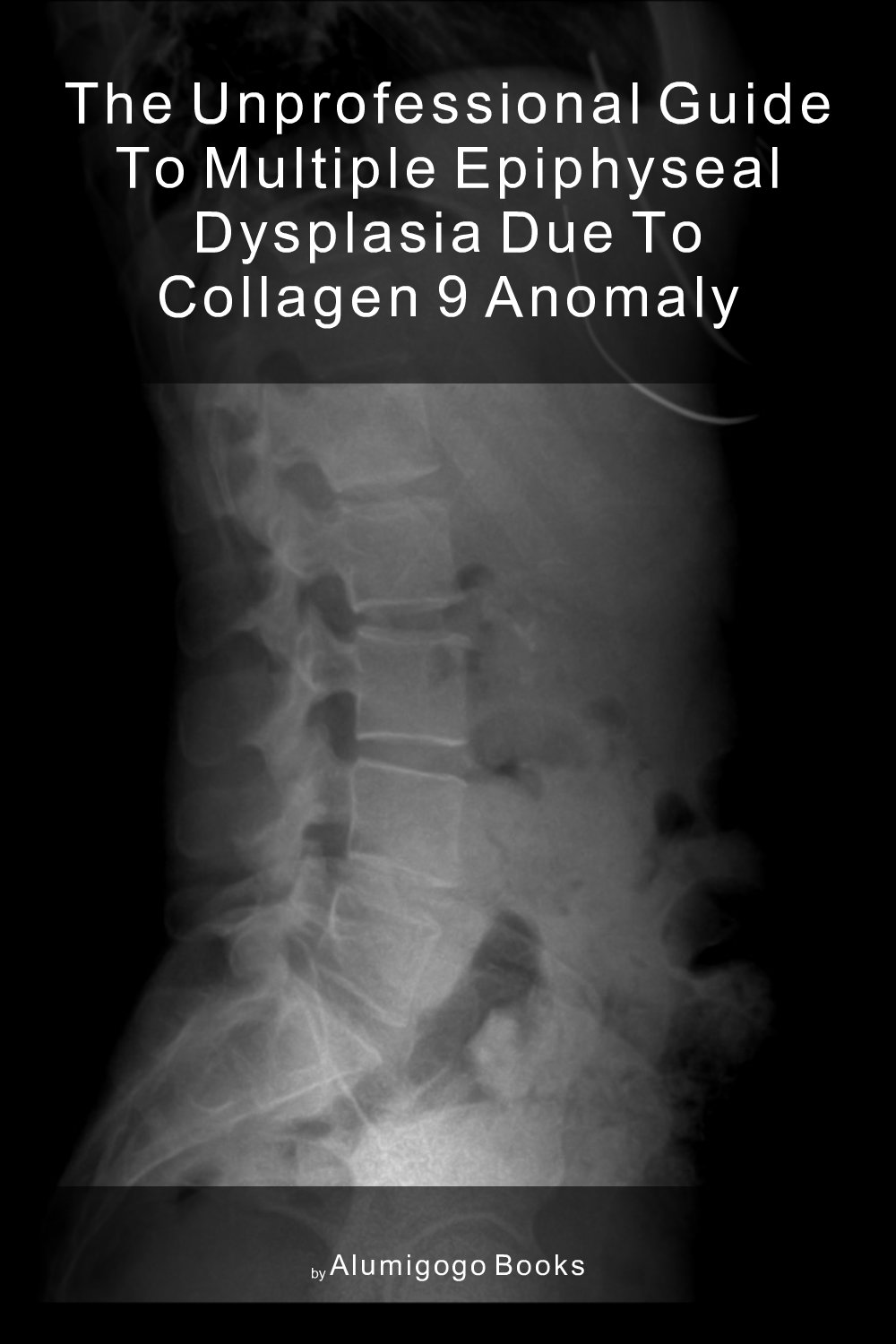 Cover of The Unprofessional Guide to multiple epiphyseal dysplasia due to collagen 9 anomaly