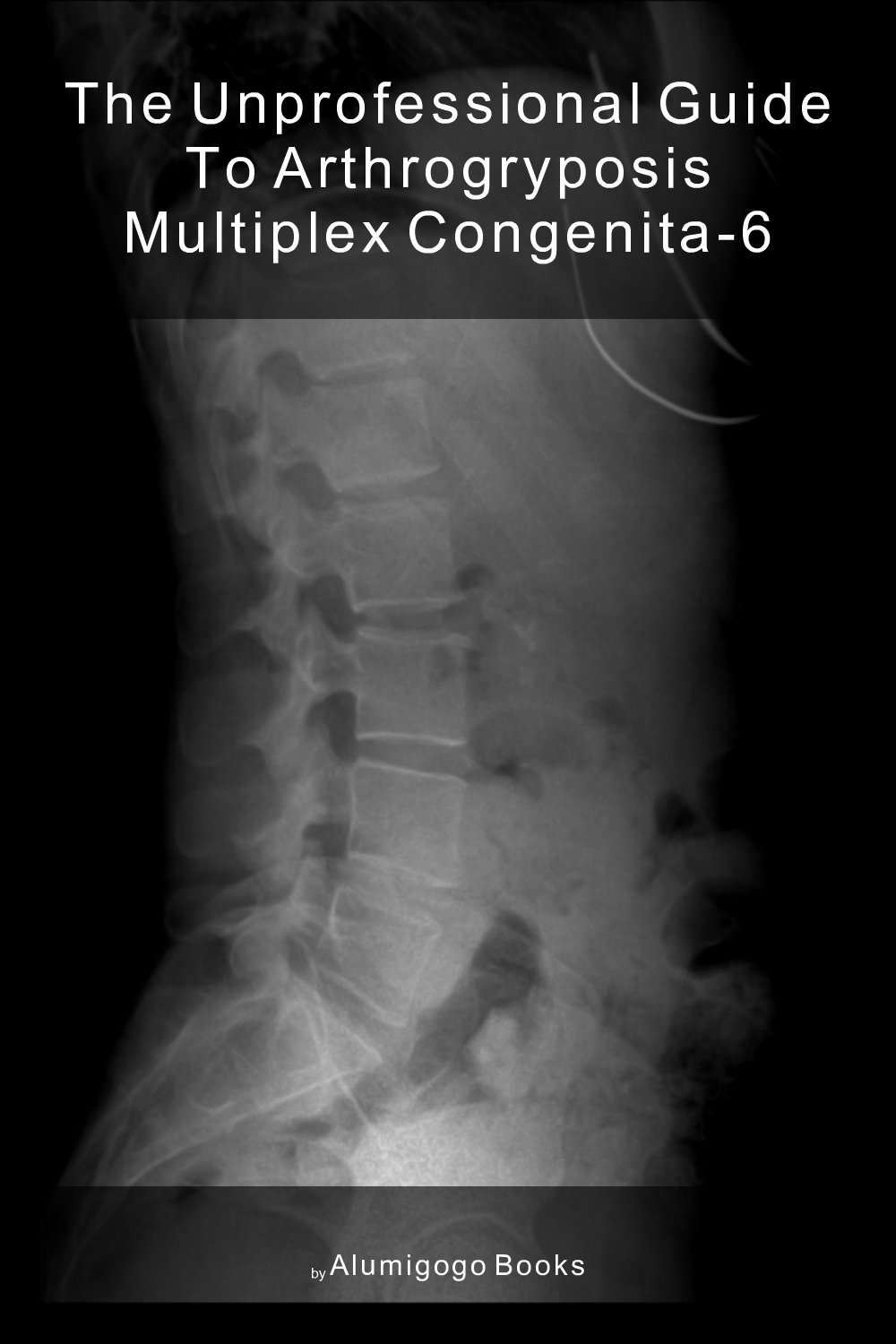 Cover of The Unprofessional Guide to arthrogryposis multiplex congenita-6
