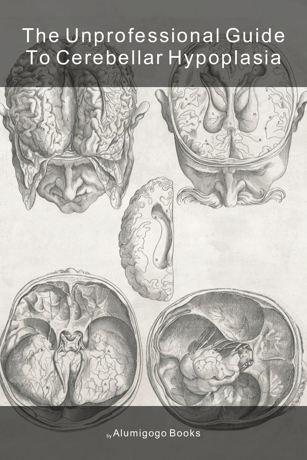 Cover of The Unprofessional Guide to cerebellar hypoplasia